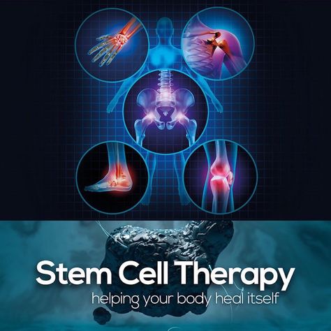 Cord Blood Banking, Umbilical Cord, Med Tech, Stem Cell Therapy, Cell Therapy, Regenerative Medicine, Body Healing, Sports Medicine, Cardiovascular Disease