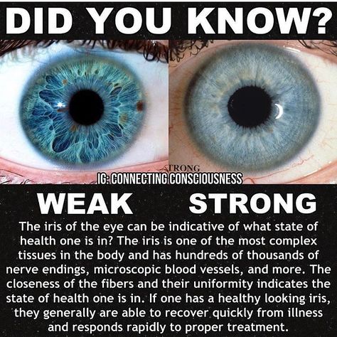 Thad Cheatham on Instagram: “This is a very good example of why every single one of us needs a good iridology reading! 👁 Just so we can see where we sit at genetically…” Connecting Consciousness, Iridology Chart, Body Reading, Ophthalmic Technician, Dr Morse, Mysterious Things, Healthy Thoughts, Alkaline Vegan, Eye Facts