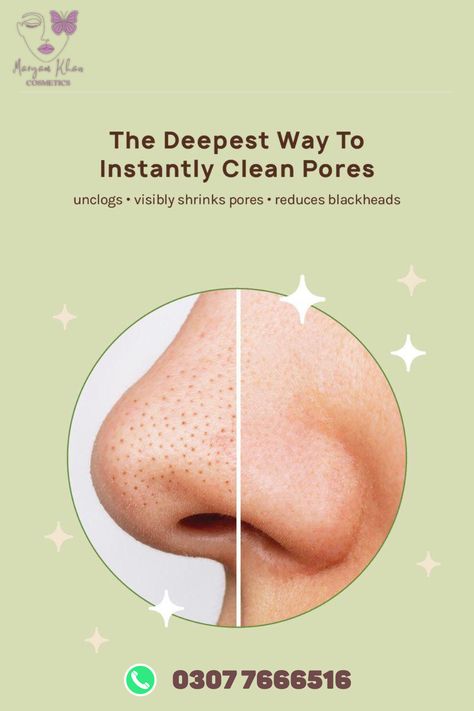 ORIGINAL APK NOSE STRIPS NOW AVAILABLE IN 599 PKR

SAY BYE TO DEAD PORES NOSE.

Nourish nose skinIt removes all dirt ,Pore ,Black heads from skin and makes nose skin shinier , clear .

#deal #sales #essence #makeup #cosmetics  #WhatsApp #XAUUSD #BackOurGirls #Iphone15 #PakvsSri How To Hide Pimples, Nose Peeling, Pimple Mask, Pimple Solution, Pimple Free Skin, Nose Pore Strips, Acne Patches, Nose Pores, Blackheads On Nose