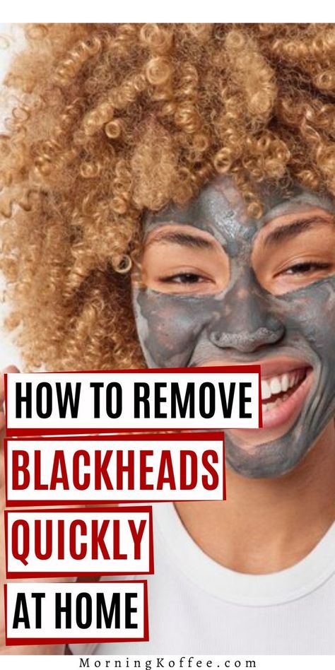 How To Remove Blackheads Quickly at Home ~Morningko #beauty #beautyhacks #pimple #acne, #pimples #overnightpimples #removepimples #removepimplesovernight https://whispers-in-the-wind.com/combatting-pimples-under-the-skin-expert-tips-and-product-recommendations/?166 Remedies For Blackheads, How To Remove Blackheads, For Blackheads, Blackhead Remedies, Pimples Under The Skin, To Remove Blackheads, Rid Of Blackheads, Pimples Remedies, Pimples On Face