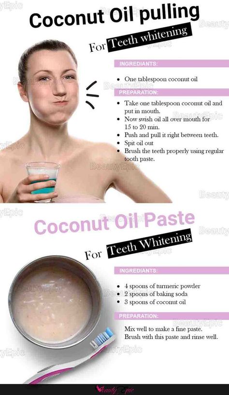 Coconut Oil Teeth Whitening, Benefits Of Coconut, Coconut Oil For Teeth, Teeth Whitening Remedies, Coconut Oil Pulling, Benefits Of Coconut Oil, Oil Pulling, Stained Teeth, Natural Teeth Whitening