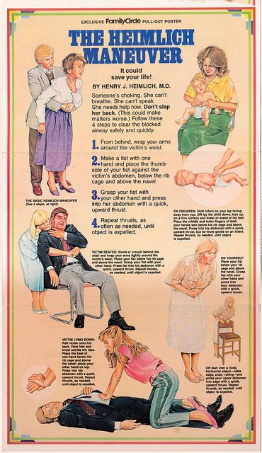 vintage heimlich maneuver poster http://www.pinterest.com/sthomas68/occupational-and-physical-therapy/ Heimlich Maneuver, First Aid Tips, Emergency First Aid, Emergency Medicine, Survival Life, Medical Knowledge, Emergency Prepping, Medical Education, Medical Information