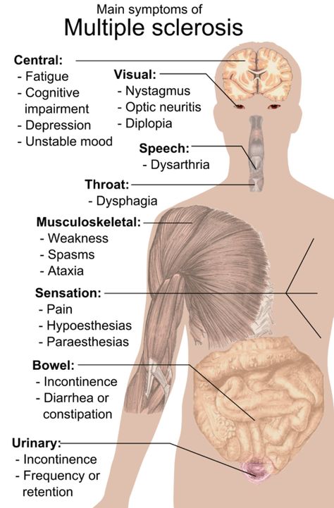 Multiple Sclerosis Symptoms, Ms Symptoms, Ms Awareness, Multiple Sclerosis Awareness, Med Student, Neurology, Signs And Symptoms, The Human Body, Autoimmune Disease