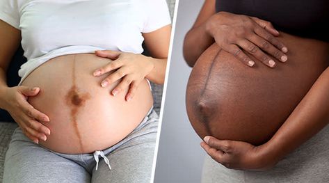 Linea Nigra: Here’s What’s Up With That Pregnant Belly Line Pregnant Belly, Black Line, Black