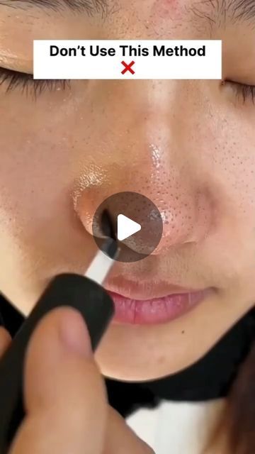 How To Get Rid Of Whiteheads On Nose, Black And White Heads Removal, How To Remove Blackheads From Face, Face Blackheads Removal, How To Get Rid Of Black Heads On Nose, How To Remove Black Heads, White Heads Removal Remedies, Black Heads On Nose, How To Get Rid Of Eye Bags