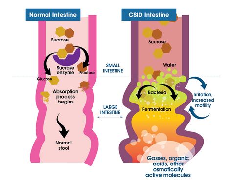 What Starch Foods, Failure To Thrive, Gut Issues, Gi Tract, Starchy Foods, Carbohydrate Diet, Large Intestine, Abdominal Pain, Baby Formula