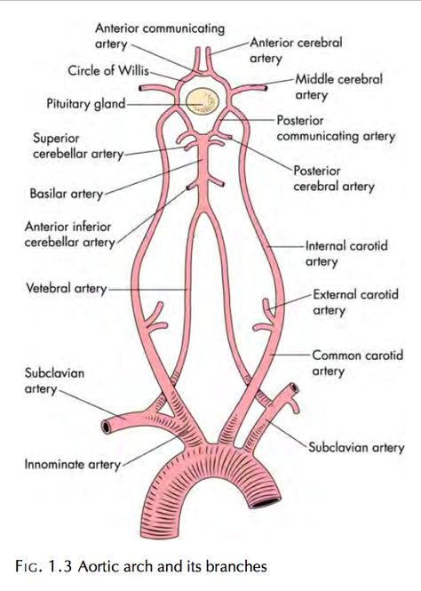 Branches if the Aortic Arch Aortic Arch, Upper Limb Anatomy, Arteries Anatomy, Vascular Ultrasound, Abdominal Aorta, Radiology Student, Diagnostic Medical Sonography, Radiology Imaging, Interventional Radiology