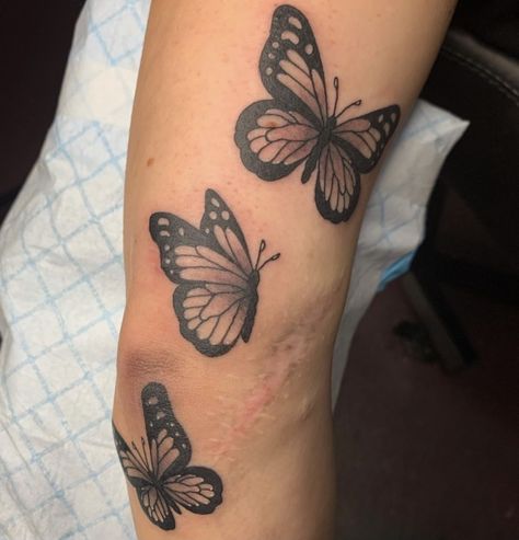 Butterfly Tattoo Scar Cover, Butterfly Tattoo Over Scar, Tattoos Around Scars, Tattoo Scar Cover, Tattoo Scar, Tattoo Over Scar, Tattoos To Cover Scars, Favorite Tattoos, Butterfly Tattoos