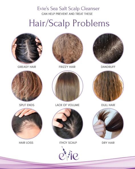 Layers Haircut, Monat Business, Low Porosity Hair, Scalp Problems, Help Hair Grow, Understanding Emotions, Low Porosity, Low Porosity Hair Products, Hair Dandruff