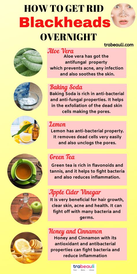 How To Remove Blackheads At Home Permanently – Best Beauty Lifestyle Blog How To Remove Blackheads, Blackhead Remedies, To Remove Blackheads, Rid Of Blackheads, Cold Medicine, Losing 40 Pounds, Home Remedy For Cough, Cold Sores Remedies, Remove Blackheads