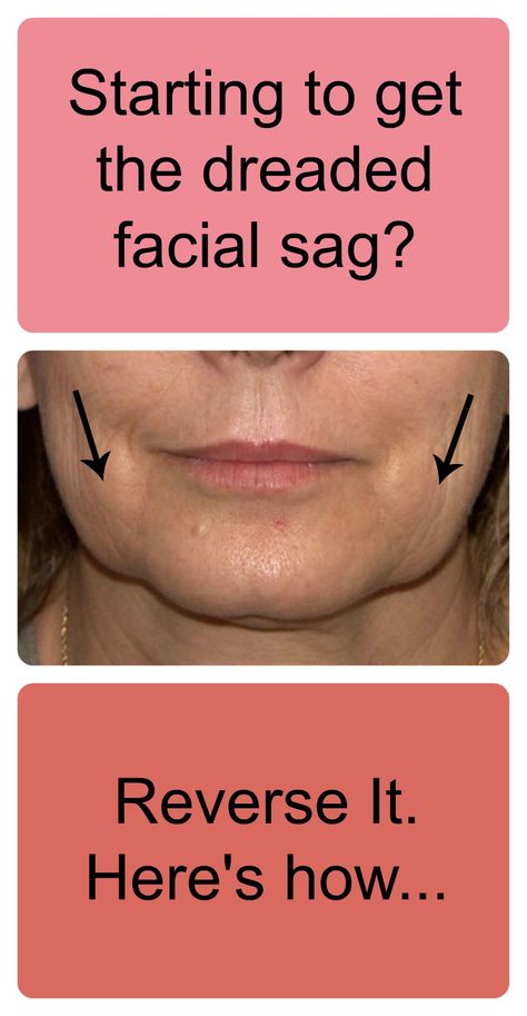 Lift Your Face In Only Minutes A Day. Exercise PLUS Weight Resistance. Get small, soft Face Weights at FaceWeights.com Face Lift Exercises, Face Lift Surgery, Anti Aging Food, Face Exercises, Glow Skin, Facial Exercises, Facial Muscles, Face Lift, Muscle Tone