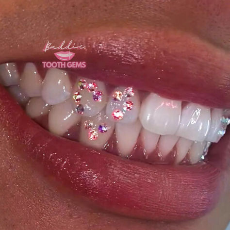 Tooth Gem Design Ideas, Piercing No Dente, Teeth Jewelry Tooth Gems, Teeth Gems Ideas, Tooth Gem Designs, Tooth Gems Aesthetic, Tooth Gem Placement, Teeth Gems, Pretty Teeth