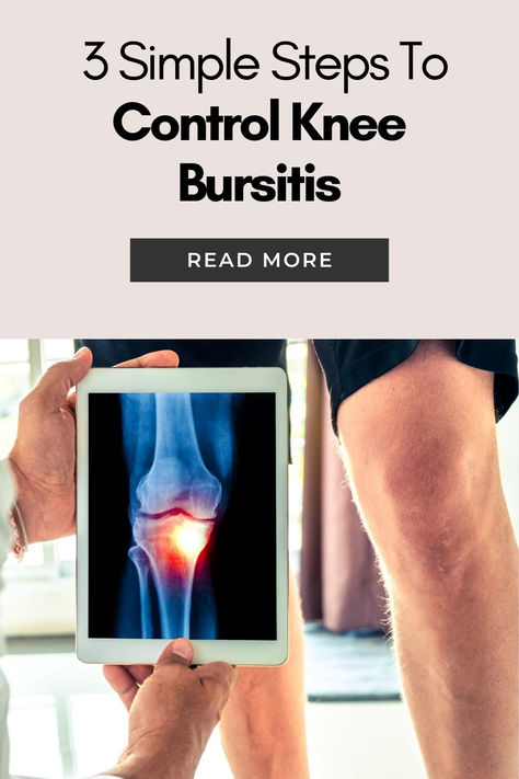 Knee bursitis is a painful condition caused by inflammation of the bursa, a small fluid-filled sac that cushions and reduces friction in the knee joint. It often results from repetitive stress, prolonged kneeling, or trauma to the knee. If left untreated, knee bursitis can become a chronic issue, significantly affecting quality of life. Discover 3 simple, effective options from MendMeShop that can help control knee bursitis pain and get you moving again. Take charge of your recovery today! Knee Bursitis, Bursitis Knee, Bursitis Hip, Soft Tissue Injury, Knee Pillow, Pain Relief Cream, Scar Tissue, Knee Injury, Take Charge