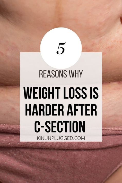 C Section Stomach Exercises, Fitness After C Section, Flat Tummy After C Section, Lose Baby Weight After C Section, C Section Overhang Belly, Flat Stomach After C Section, 1 Month Post Partum Belly, Belly Binding After C Section, Losing Weight After C Section