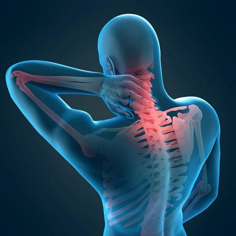 How to Relieve Stiff Neck Pain Using Trigger Point Massage at Home - Massage Neck And Shoulders, Massage Neck, Trigger Point Massage, Stiff Neck, Trigger Point, Self Massage, Trigger Points, Body Pain, Massage Techniques