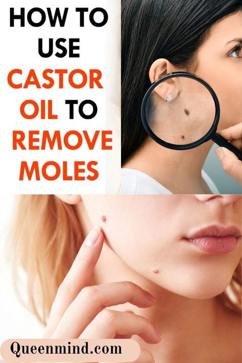 How To Use Castor Oil To Remove Moles Essential Oil To Remove Moles, Castor Oil Belly Button Remedy, Castor Oil For Scar Tissue, Castor Oil Face Moisturizer, Castor Oil For Nails, How To Remove Moles From Face, Castor Oil For Wrinkles Faces, Castor Oil Uses Stomach, Castor Oil Before And After