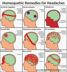 Natural homeopathic remedies for 9 types of headaches. A great alternative to modern medications - effective, natural. Sinus headache? Hangover? Migraine? How To Stop Migraines, Remedies For Headaches, Natural Headache, For Headaches, Headache Types, Sinus Headache, Natural Headache Remedies, Migraine Relief, Headache Relief