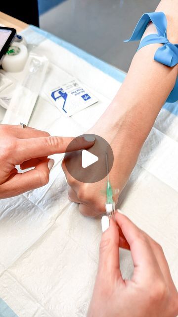 Nursing Iv Insertion, Iv Placement, How To Find Vein For Iv, Iv Catheter Sizes, Central Venous Catheter Nursing, Intravenous Drip, Iv Therapy Complications, Nursing Iv, Intravenous Injection