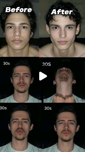 Fat Grafting Face, Reduce Cheek Fat Facial Exercises, Facial Flex Face Exercises, Facial Fat Loss, Yoga For Face Fat Loss, Facial Fitness, Full Makeup, Glowing Skincare, Facial Exercises