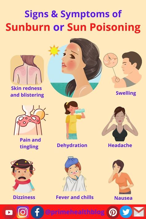 Sun poisoning doesn’t really mean that you’ve been poisoned. It is frequently the term used for a serious case of sunburn. This is usually a burn from ultraviolet (UV) radiation which inflames your skin. Within just 15 minutes of being in the sun, you can be sunburned. However, you might not know it straight away. The redness and distress may not show up for a few hours. You can become severely sunburned if you stay in the sun for a long time and do not wear protection. Sun Poisoning, Skin Burns, What Makes You Beautiful, Skin Redness, Signs And Symptoms, Show Up, Headache, Womens Health, 15 Minutes