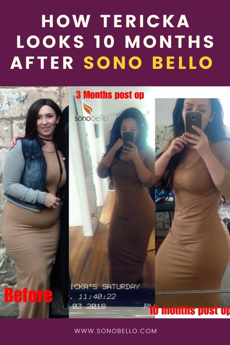 Sonobello Price, Sonobello Before And After Stomach, Sonobello Before And After, Post Op, Summer Ready, Body Image, New You, Inspire Others, Feel Confident