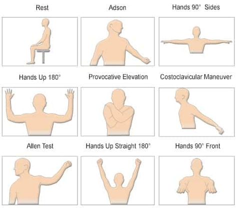 Thoracic Exercises, Carpel Tunnel Syndrome, Thoracic Outlet, Carpel Tunnel, Gait Cycle, Pta School, Neck Yoga, Tight Hip Flexors, Psoas Muscle