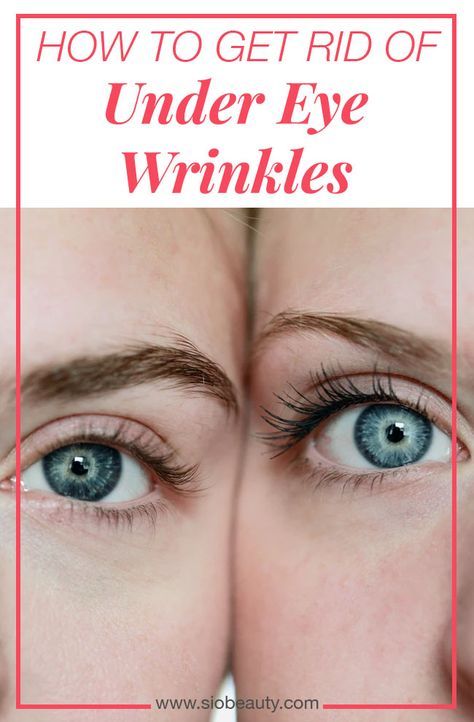 Looking Younger, Eye Wrinkles, Under Eye Wrinkles, Under Eyes, Eye Wrinkle, Diy Skincare, Anti Aging Tips, Face Scrub, Look Younger