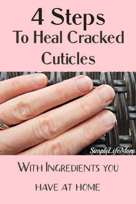 home remedies for healthy nails How To Heal Cuticles Fast, Shea Lotion Recipe, Cracked Hands Remedy, Dry Cracked Cuticles, Traditional Homemaking, Cracked Heel Remedies, Cuticle Repair, Nail Remedies, Shea Butter Moisturizer