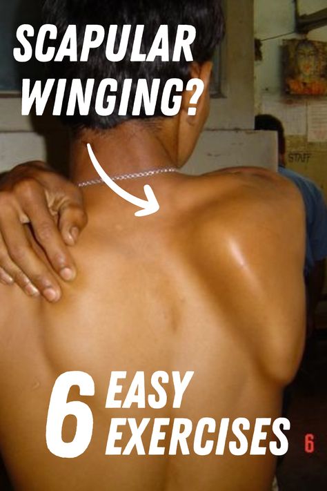 Winging of scapula is a rare condition in which the affected side scapula protrudes away from the body. The sufferer of this rare condition affects the ability to pull, push heavy objects, and lift objects and it also hampers daily activities such as brushing hair and teeth and carrying grocery bags. For some, it also concerns them cosmetically. However, exercise has been found to be effective in managing this kind of disability. Scapula Pain, Winged Scapula Exercises, Scapular Winging, Scapula Exercises, Winged Scapula, Scapula Bone, Brushing Hair, Wall Push Ups, How To Help Nausea