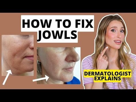 How to Fix Jowls: Dermatologist Explains How to Prevent & Get Rid of Jowls | Dr. Sam Ellis - YouTube How To Reduce Sagging Jowls, How To Get Rid Of Saggy Jowls, How To Get Rid Of Jowls Sagging Skin, How To Get Rid Of Jowls Naturally, Get Rid Of Jowls The Face, Jowel Exercises Face, How To Get Rid Of Jowls, Jowls Sagging, Jowl Exercises