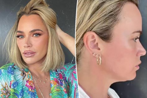 Teddi Mellencamp: 'Everybody went crazy' over neck lift Teddy Mellencamp Hair, Teddy Mellencamp, Teddi Mellencamp, Real Housewives Of Beverly Hills, Neck Lift, Under The Knife, Housewives Of Beverly Hills, Loose Skin, Real Housewives