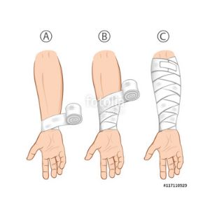 Forearm - The part of a person's arm extending from the elbow to the wrist or the fingertips. Draw Tutorial, Elbow Braces, Hand Drawing Reference, Poses Reference, Hand Drawing, Anime Poses Reference, Anime Poses, Pose Reference, Drawing Reference