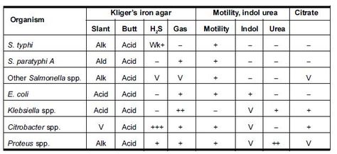 Biochemical test for Salmonella Culture Media Microbiology Notes, Proteins Biochemistry, Pathogenic Microbiology, Microbiology And Parasitology, Lab Science, Biochemical Tests Microbiology, Culture Media, Medical Laboratory, Science Lab