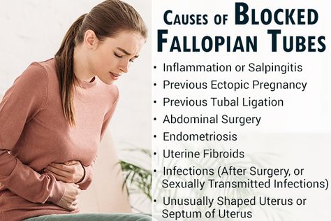 How Are Blocked Fallopian Tubes Diagnosed and Treated Fallopian Tube Blockage, Blocked Fallopian Tubes, Fibroid Tumors, Fertility Awareness, Ectopic Pregnancy, Abdominal Surgery, Ivf Cycle, Types Of Surgery, Female Reproductive System