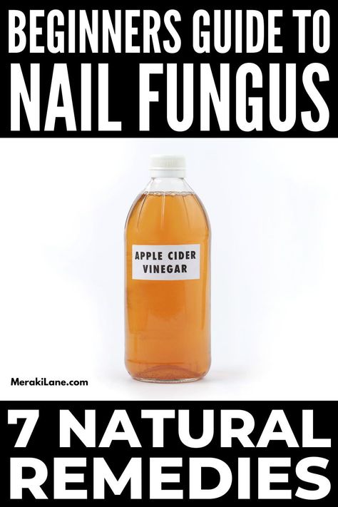 7 Home Remedies for Nail Fungus That Work | Nail fungus is common but unpleasant. It can appear on your fingernails and toenails, causing discoloration, cracks, and brittle nails. Thankfully, it can be cured, and we're curated the best homemade natural remedies to get rid of toenail fungus fast. Click to find out how you can get rid of a toenail fungal infection ASAP using ingredients you probably already have on hand, like apple cider vinegar, essential oils, black tea, and more! Black Toenail Fungus, Fungal Infection Remedies, Toenail Fungal Infection, Nail Remedies, Fingernail Fungus, Toenail Fungus Remedies, Nail Fungus Remedy, Nail Infection, Fungal Nail