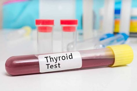 If you have been getting thyroid tests done, understand why they lack accuracy and what you can do to naturally improve thyroid health. T3 Hormone, Thyroid Awareness Month, Thyroid Imbalance, Thyroid Test, Cholesterol Test, Thyroid Symptoms, Thyroid Medication, Lipid Profile, Thyroid Function