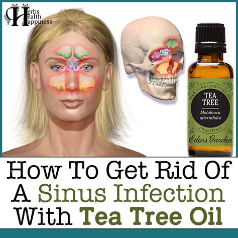 Herbs Health & Happiness How To Get Rid Of A Sinus Infection With Tea Tree Oil - Herbs Health & Happiness Natural Sinus Infection Remedy, Sinus Infection Relief, Essential Oils Sinus, Tea Witch, Oils For Sinus, Sinus Infection Remedies, Herbalife Tea, Moderate Acne, Nature Healing