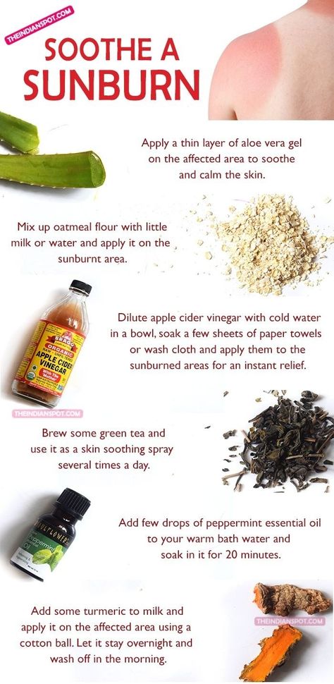 Burn Remedies, Natural Remedies For Sunburn, Sunburn Remedies, Natural Beauty Remedies, Sun Burn, Skin Natural Remedies, Anti Aging Oils, Holistic Remedies, Beauty Remedies