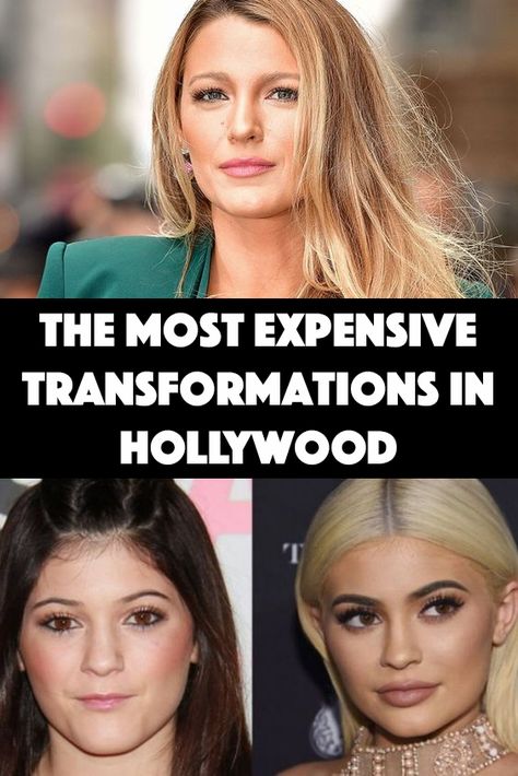 The Most Expensive Transformations In Hollywood Plastic Surgery Gone Wrong, Celebrity Costumes, Celebrity Memes, Celebrity Makeup Looks, Celebrity Plastic Surgery, Pinterest Design, Nose Job, Makeup Transformation, Celebrity Makeup