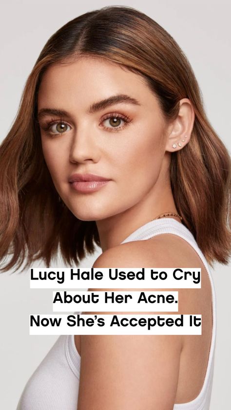 The actor shares her skin journey and must-have products for Glamour’s Acne Diaries. Celebrities With Acne, Skin Journey, Celebrity Acne, Maggie Q, Influential Women, Clear Complexion, Lucy Hale, Celebrity Beauty, Skin Healing