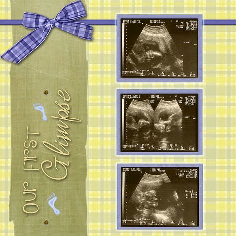 Ideas for an ultrasound page Ultrasound Pictures Scrapbook, Ultrasound Scrapbook, Multi Photo Scrapbook Layouts, Pregnancy Scrapbook, Sonogram Pictures, Baby Boy Scrapbook Layouts, Baby Ultrasound, Baby Scrapbook Album, Ultrasound Pictures