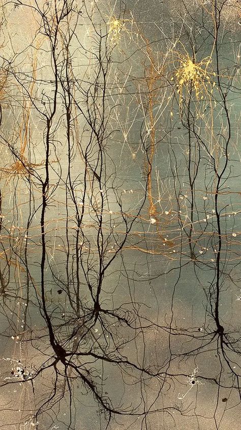 Brain Painting, Neuroscience Art, Neurology Art, Brain Neurons, Biology Art, Brain Art, Bio Art, Medical Art, A Level Art