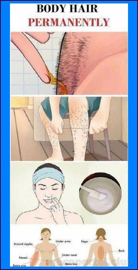 Brazilian Hair Removal, Best Permanent Hair Removal, Chin Hair Removal, Permanent Hair Removal Cream, Upper Lip Hair Removal, Permanent Facial Hair Removal, Back Hair Removal, Best Facial Hair Removal, Leg Hair Removal