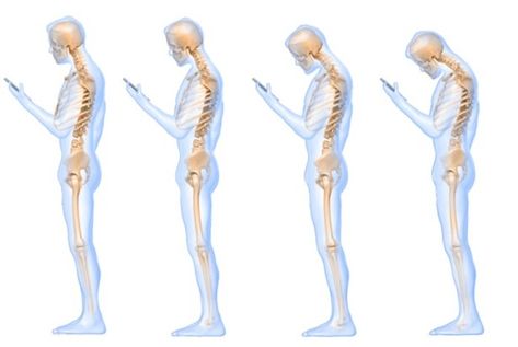 A new study suggests that looking down at a cell phone is the equivalent of placing a 60-pound weight on one's neck. Healthier Me, Text Neck, Healthy Spine, Tight Hip Flexors, Psoas Muscle, Chronic Migraines, Bad Posture, Tight Hips, A Cell