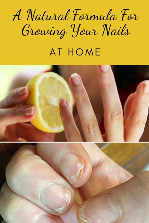 Nail Growth Faster, Grow Long Nails, Essential Oils For Hair, How To Grow Nails, Nail Growth, Best Shampoos, Nail Health, Healthy Nails, Nails At Home