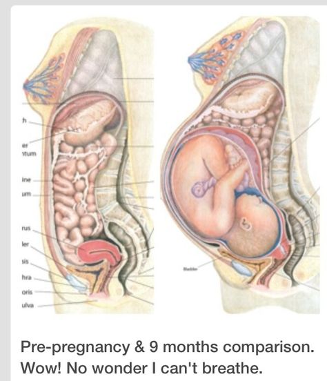 No wonder I'm in so much pain. 9 Month Pregnant, 36 Weeks Pregnant, 36 Weeks, Pregnancy Labor, Being Pregnant, Weeks Pregnant, Fingers Crossed, Pregnancy Birth, Baby Time