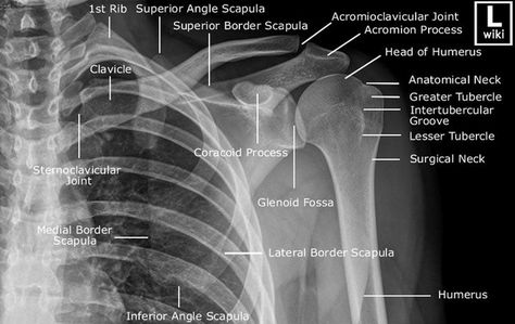 Shoulder girdle radiograph Xray Anatomy, Radiology Schools, Shoulder Anatomy, Radiologic Technology, Radiology Student, Radiology Imaging, Radiology Technologist, Diagnostic Imaging, Medical Imaging