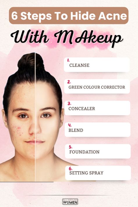 6 Steps To Hide Acne With Makeup, acne scars, makeup tips How To Hide Pimples With Makeup, Hide Acne With Makeup, How To Hide Pimples, Acne With Makeup, Pimple Hacks, Makeup Tutorial Foundation Flawless Face, Face Makeup Routine, Beginner Skin Care Routine, Makeup Starter Kit