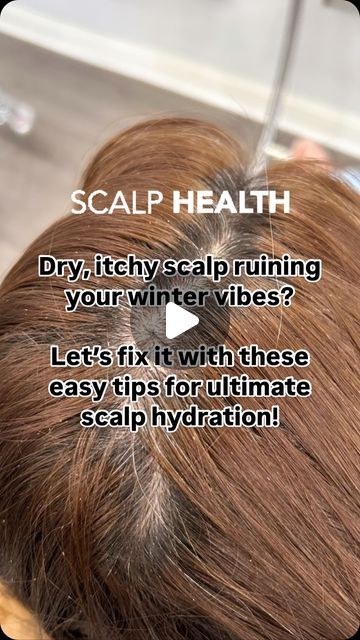 Diana Paulino on Instagram: "✨Dry, itchy scalp during winter can feel like the ultimate beauty buzzkill, but don’t worry—I’ve got you covered! Here’s why it happens and how to fix it for good.

✨Why It Happens:
When the temperature drops, so does the humidity. The cold, dry air zaps moisture from your scalp, leaving it tight, flaky, and itchy. Hot showers don’t help—they strip natural oils, making things worse!

✨Hydrate from the Inside Out 💧
Drink water like your scalp depends on it (because it does)! Include omega-3-rich foods like avocado or flaxseed to support scalp health. Bonus: It’s great for your hair, too!

✨Swap Your Products 🧴
Use a gentle, sulfate-free shampoo and add a deep-conditioning mask once a week. Scalp oils or treatments with ingredients like tea tree or jojoba oil c Dry Itchy Scalp, Skin Patches, Scalp Oil, Dry Air, Itchy Scalp, Scalp Health, Sulfate Free Shampoo, Flaxseed, Deep Conditioning