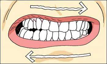 Teeth Problems, Salamanca Madrid, Teeth Grinding, Family Dental, Grinding Teeth, Dental Practice, Ap Art, Salamanca, Dental Health